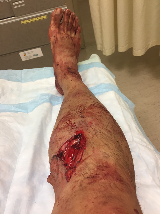 Gory, eh?